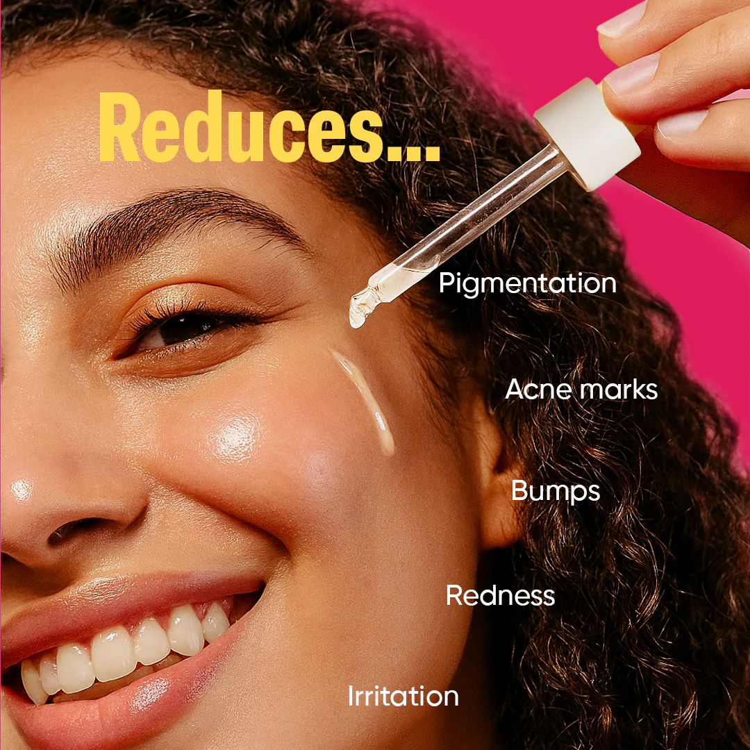 NXTFACE 10% Azelaic Acid - Fadeout Serum | 30ml - Image 5