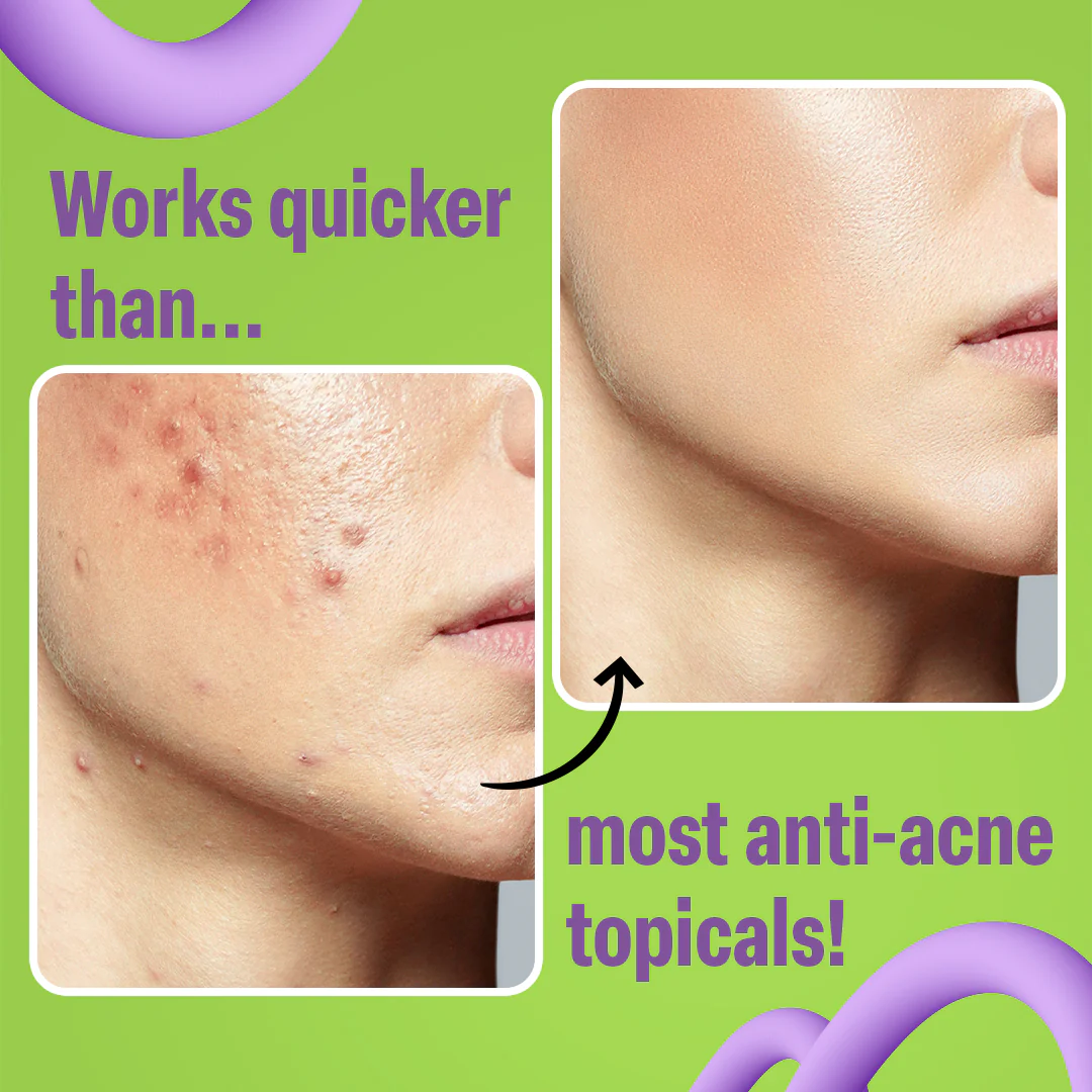 NXTFACE 3% Zinc Sebum - Clarifying Serum | 30ml - Image 7